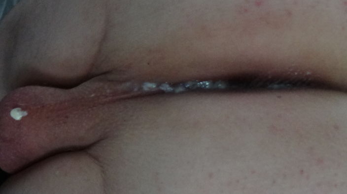 0006