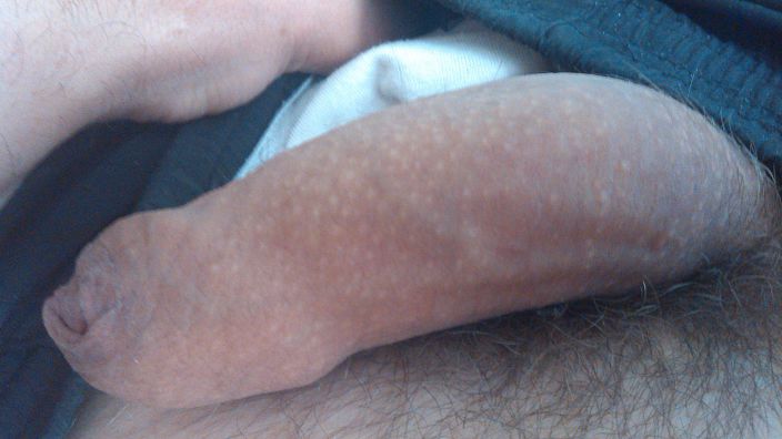 xxx