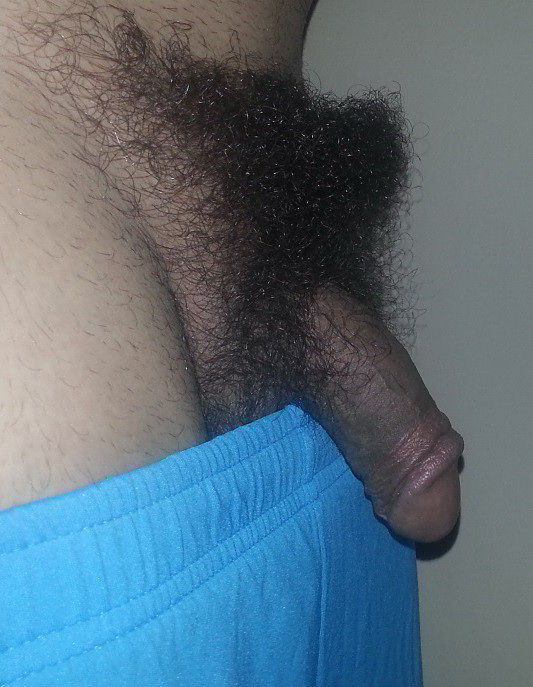 Hairy