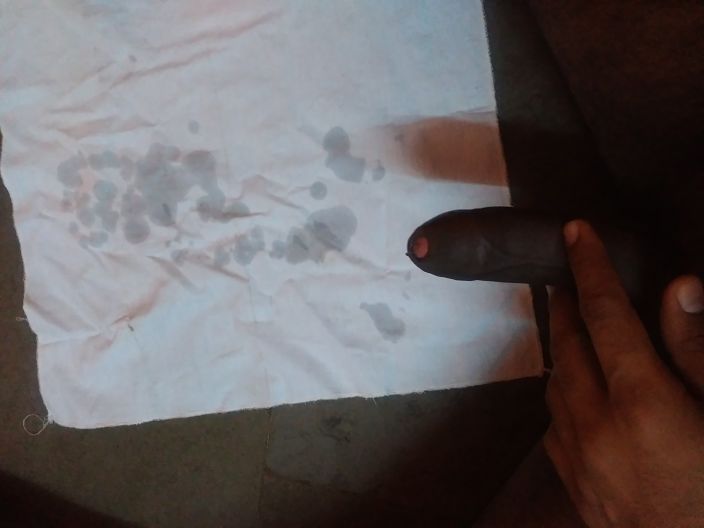 Sperm come out