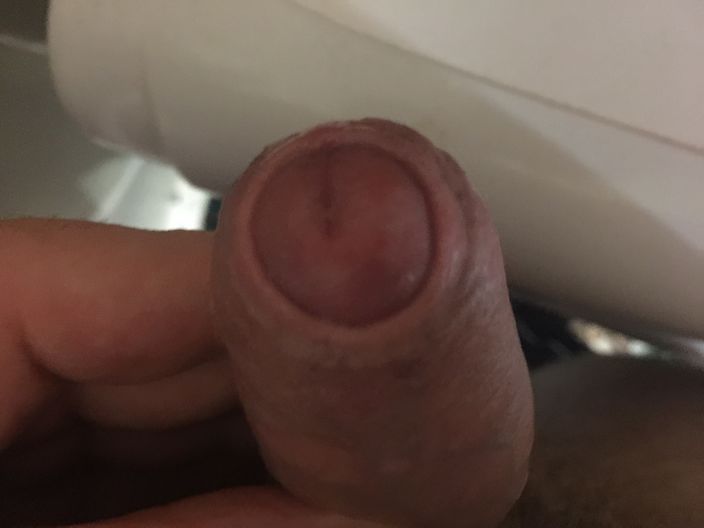 XXX