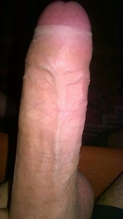 MY DICK