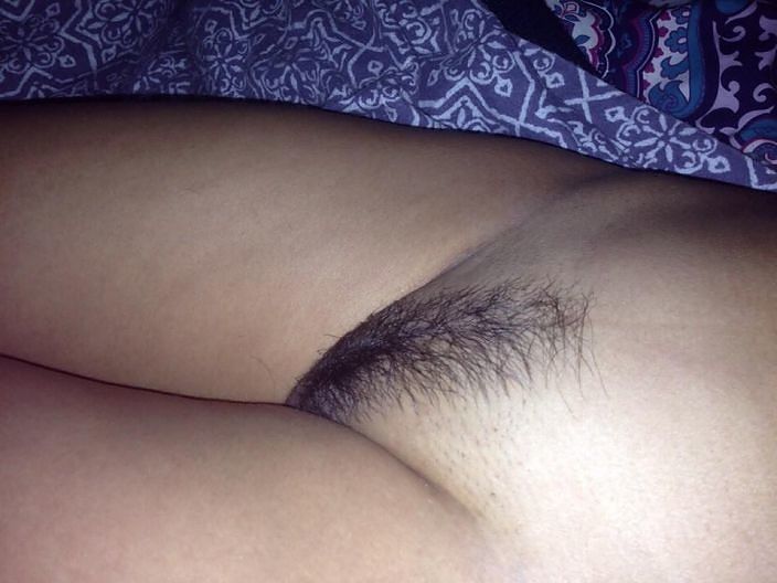 My X hairy